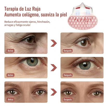 Infografía de terapia de luz roja de GlaceSkin para aumentar la producción de colágeno y suavizar arrugas en el contorno de ojos.